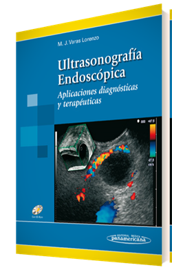 Ultrasonografía Endoscópica Aplicaciones diagnósticas y terapéu