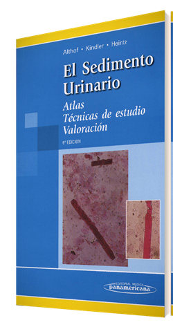 El Sedimento Urinario Atlas Técnicas de estudio Valoración