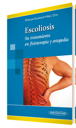 Escoliosis: Su Tratamiento En Fisioterapia Y Ortopedia