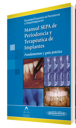 Imagen del Libro: Manual SEPA de Periodoncia y Terapéutica de Implantes Manual SEPA de Periodoncia y Terapéutica de Implantes