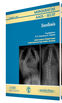 Imagen del Libro: Monografías AAOS-SECOT Monografías AAOS-SECOT