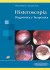 Formación - Histeroscopia