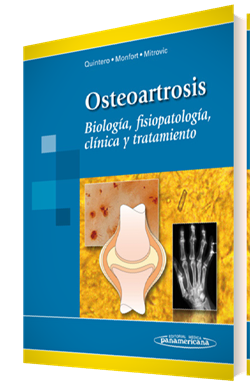 Imagen del Libro: Osteoartrosis Osteoartrosis