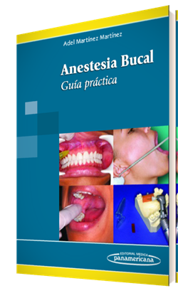 Imagen del Libro: Anestesia Bucal Anestesia Bucal