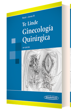 Imagen del Libro: Te Linde. Ginecología Quirúrgica Te Linde. Ginecología Quirúrgica