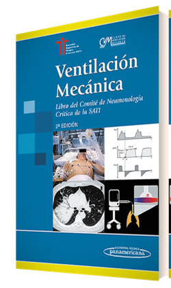 Imagen del Libro: Ventilación Mecánica Ventilación Mecánica