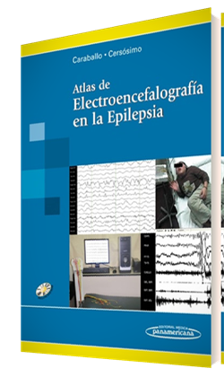 Imagen del Libro: Atlas de Electroencefalografía en la Epilepsia Atlas de Electroencefalografía en la Epilepsia
