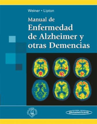 enfermedad de alzheimer libro pdf enfermedad de alzheimer libro pdf