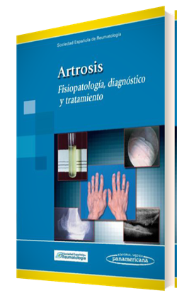 libros+de+artrosis