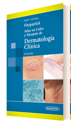 Fitzpatrick: Atlas En Color Y Sinopsis De Dermatología Clínica