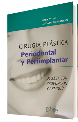 Que es la cirugia plastica periodontal