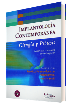 Imagen del Libro: Implantología Contemporánea Implantología Contemporánea