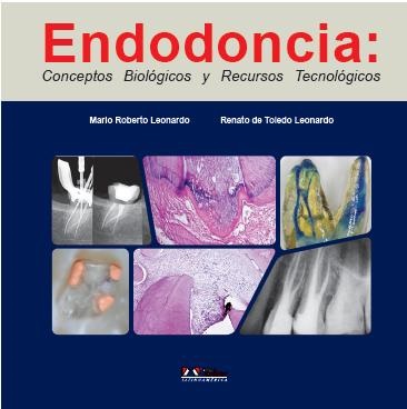 que es endodoncia pdf free