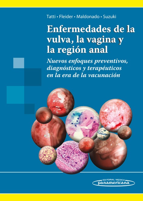 Enfermedades De La Vulva La Vagina Y La Región Anal Nuevos Enf 5867