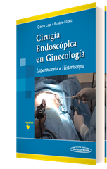 Cirugía Endoscópica en Ginecología: Material complementario