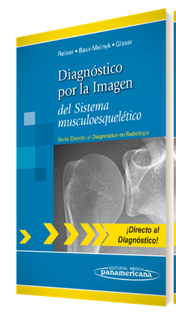 Imagen del Libro: Diagnóstico por la Imagen del Sistema musculoesquelético Diagnóstico por la Imagen del Sistema musculoesquelético