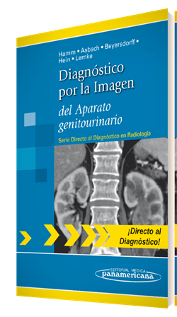 Imagen del Libro: Diagnóstico por la Imagen del Aparato genitourinario Diagnóstico por la Imagen del Aparato genitourinario