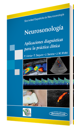 Imagen del Libro: Neurosonología Neurosonología