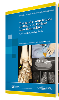 Imagen del Libro: Tomografía Computarizada Multicorte en Patología Musculoesquelética Tomografía Computarizada Multicorte en Patología Musculoesquelética