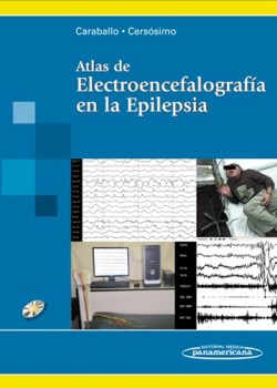 Imagen del Libro: Atlas de Electroencefalografía en la Epilepsia Atlas de Electroencefalografía en la Epilepsia