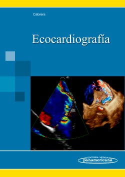 Imagen del Libro: Ecocardiografía Ecocardiografía