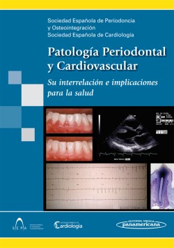 Imagen del Libro: Patología Periodontal y Cardiovascular Patología Periodontal y Cardiovascular
