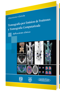 Imagen del Libro: Tomografía por Emisión de Positrones y Tomografía Computarizada Tomografía por Emisión de Positrones y Tomografía Computarizada