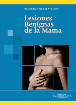 Imagen del Libro: Lesiones Benignas de la Mama Lesiones Benignas de la Mama