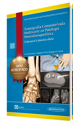 Imagen de la Obra: Curso de Tomografía Computarizada Multicorte en Patología Musculoesquelética Curso de Tomografía Computarizada Multicorte en Patología Musculoesquelética
