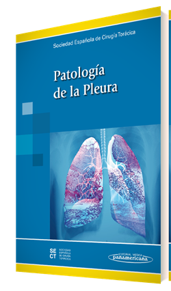 Imagen del Libro: Patología de la Pleura Patología de la Pleura