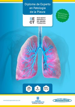 Imagen de la Obra: Experto en Patología de la Pleura Experto en Patología de la Pleura