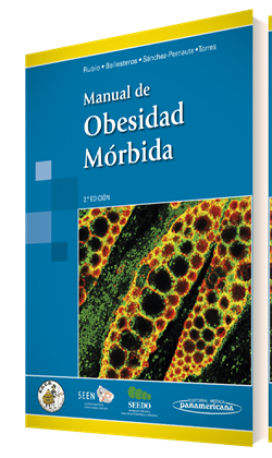 Imagen del Libro: Manual de Obesidad Mórbida Manual de Obesidad Mórbida