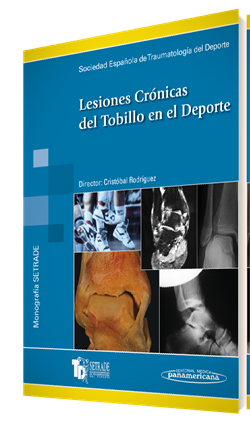 Imagen del Libro: Lesiones Crónicas del Tobillo en el Deporte Lesiones Crónicas del Tobillo en el Deporte