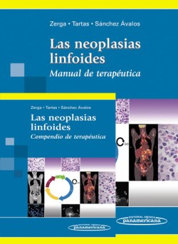 Imagen del Libro: Las neoplasias linfoides Las neoplasias linfoides