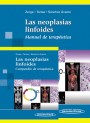 Las neoplasias linfoides Las neoplasias linfoides