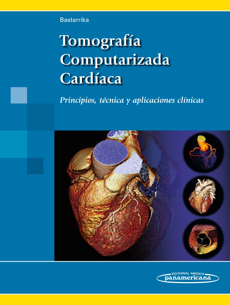 Tomografía Computarizada Cardíaca: Principios, técnica y 