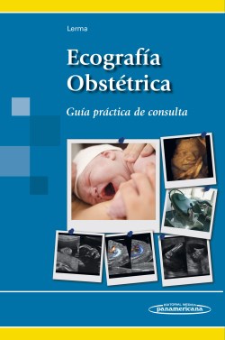Imagen del Libro: Ecografía Obstétrica Ecografía Obstétrica