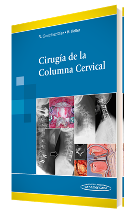 Imagen del Libro: Cirugía de la Columna Cervical Cirugía de la Columna Cervical