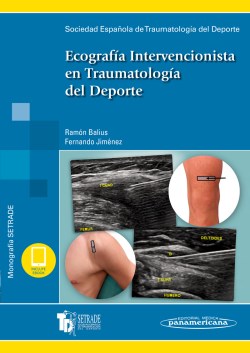 Imagen del Libro: Ecografía Intervencionista en Traumatología del Deporte Ecografía Intervencionista en Traumatología del Deporte