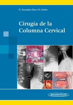 Imagen del Libro: Cirugía de la Columna Cervical Cirugía de la Columna Cervical