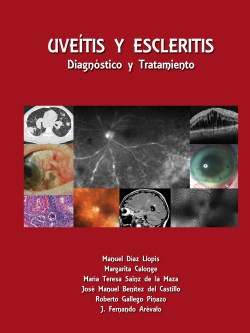 Imagen del Libro: Uveítis y Escleritis Uveítis y Escleritis