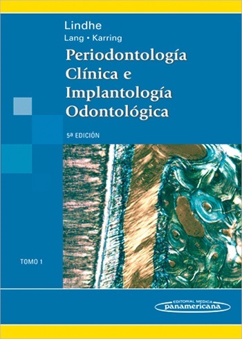 Periodontología Clínica E Implantología Odontológica: (2 Tomos)