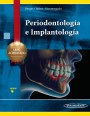 Curso Universitario de Periodontología e Implantología Curso Universitario de Periodontología e Implantología