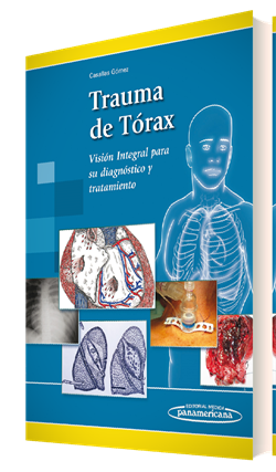Imagen del Libro: Trauma de Tórax Trauma de Tórax