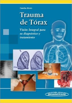 Imagen del Libro: Trauma de Tórax Trauma de Tórax