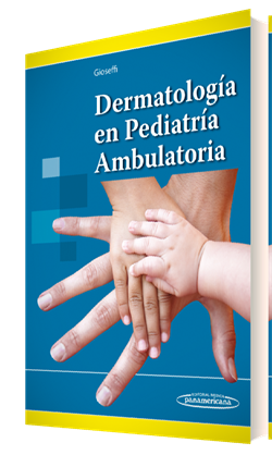 Imagen del Libro: Dermatología en Pediatría Ambulatoria Dermatología en Pediatría Ambulatoria