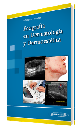 Imagen del Libro: Ecografía en Dermatología y Dermoestética Ecografía en Dermatología y Dermoestética