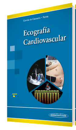 Imagen del Libro: Ecografía Cardiovascular Ecografía Cardiovascular