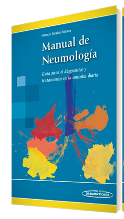 Imagen del Libro: Manual de Neumología Manual de Neumología