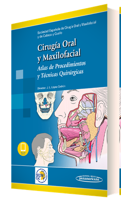Imagen del Libro: Cirugía Oral y Maxilofacial (incluye versión digital) Cirugía Oral y Maxilofacial (incluye versión digital)